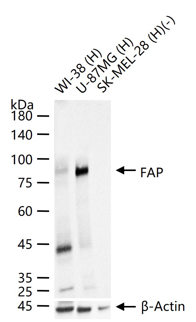 成纤维细胞激活蛋白α重组兔单抗