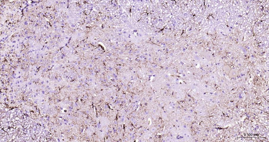 胶质纤维酸性蛋白重组兔单抗