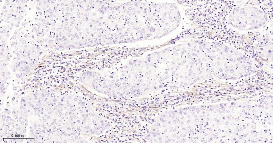 成纤维细胞激活蛋白α重组兔单抗