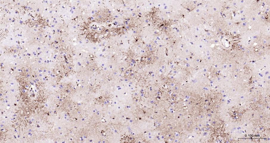 胶质纤维酸性蛋白重组兔单抗