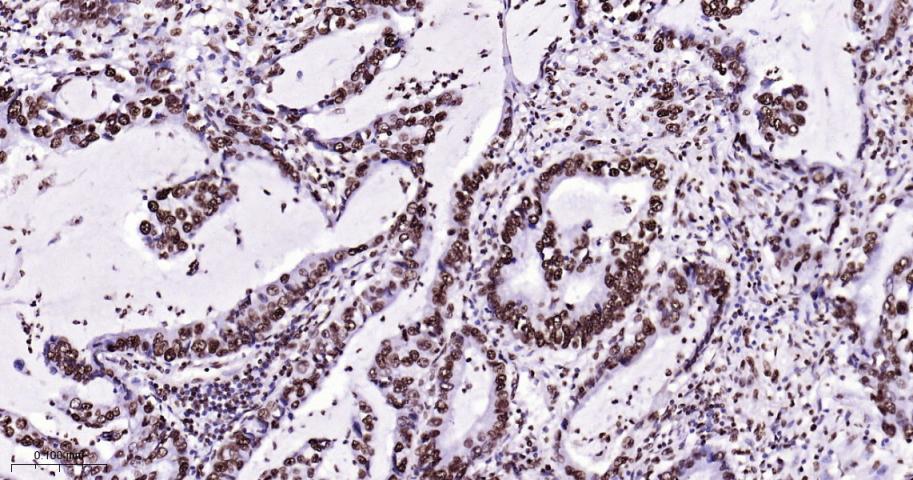 组蛋白H4重组兔单抗