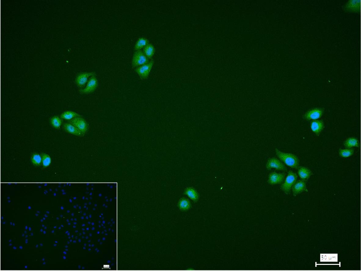 泛素样蛋白Sumo2/3重组兔单抗