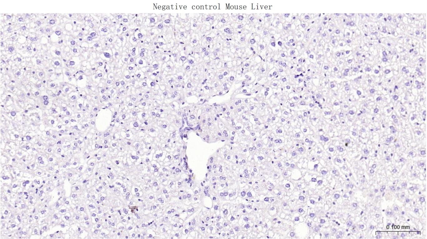 胶质纤维酸性蛋白重组兔单抗
