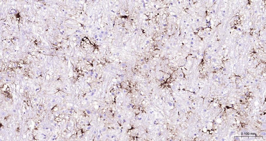 胶质纤维酸性蛋白重组兔单抗