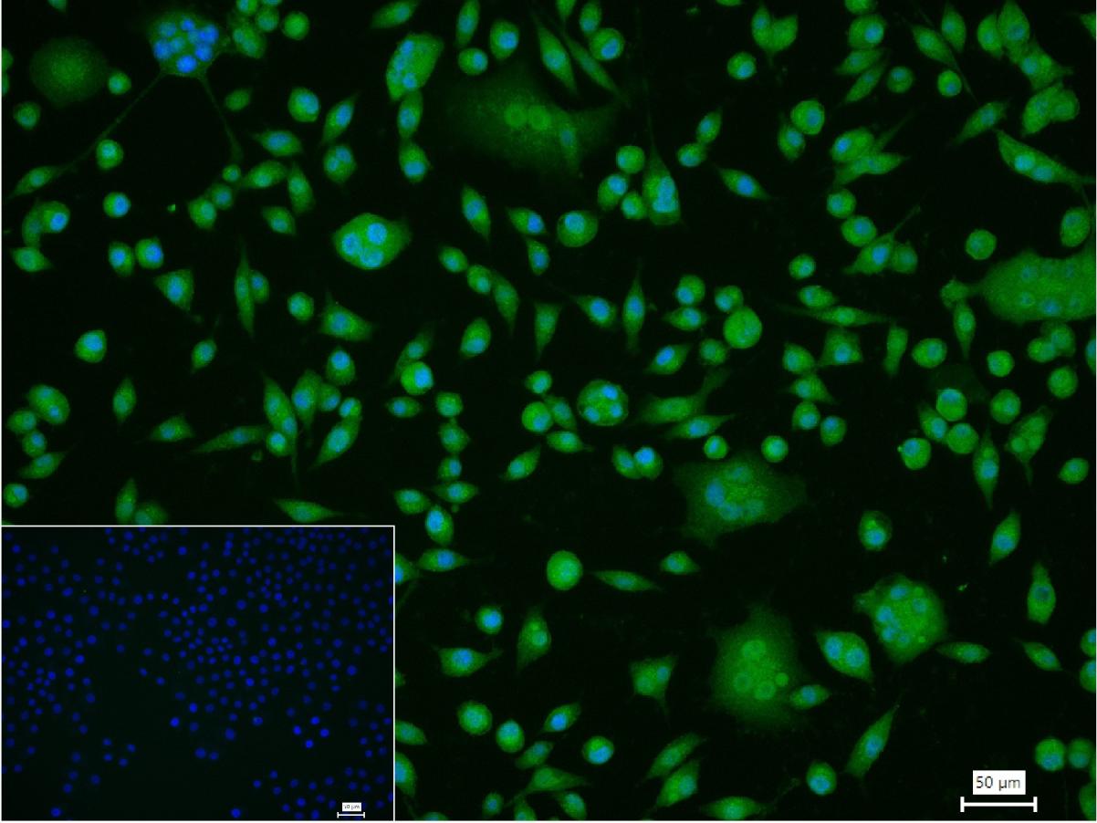 磷酸化细胞肿瘤抗原P53抗体-bs-1650R