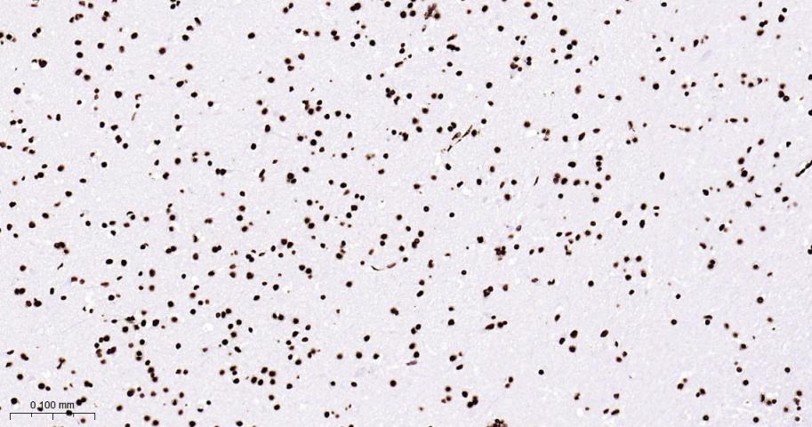 组蛋白H4重组兔单抗