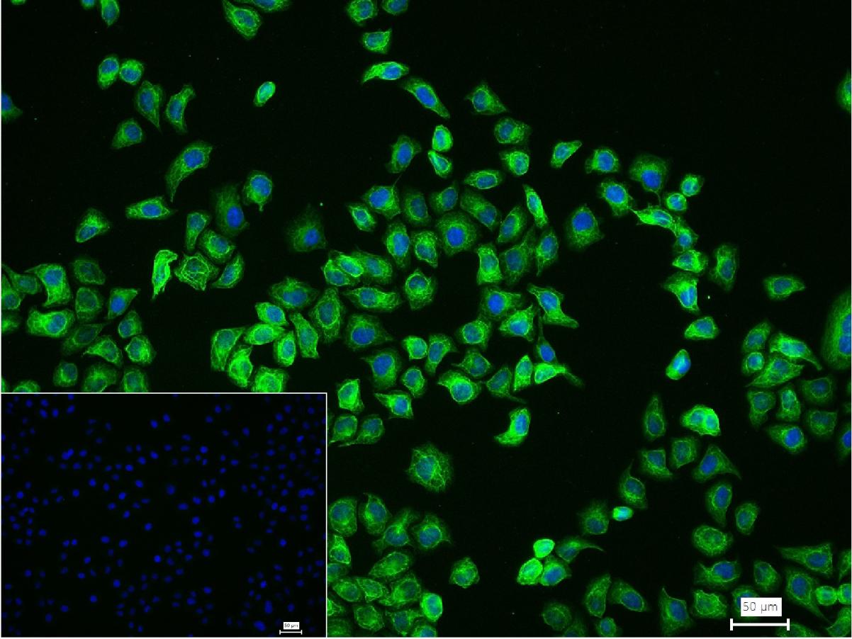 CYP1A2重组兔单抗