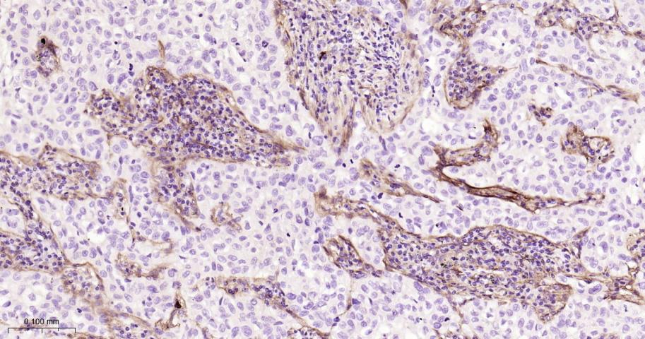成纤维细胞激活蛋白α重组兔单抗