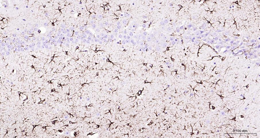 胶质纤维酸性蛋白重组兔单抗
