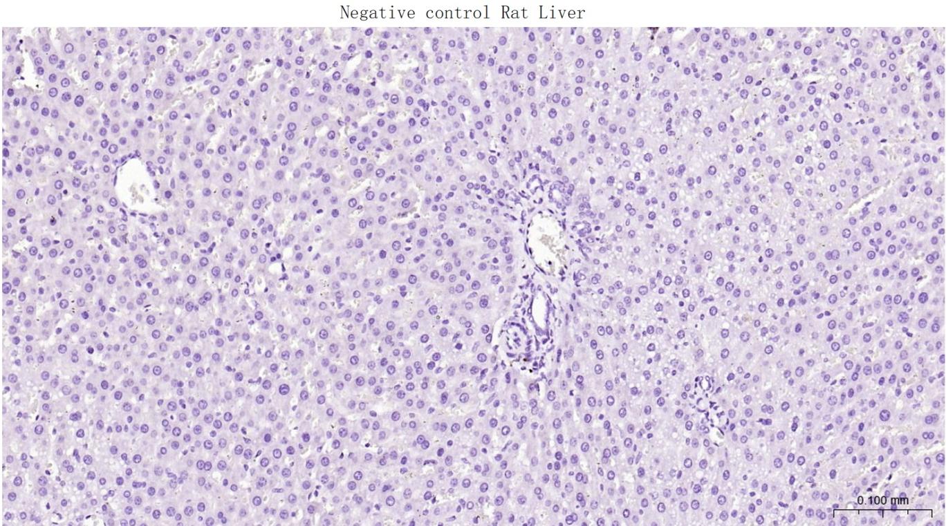 低分子量神经丝蛋白重组兔单抗