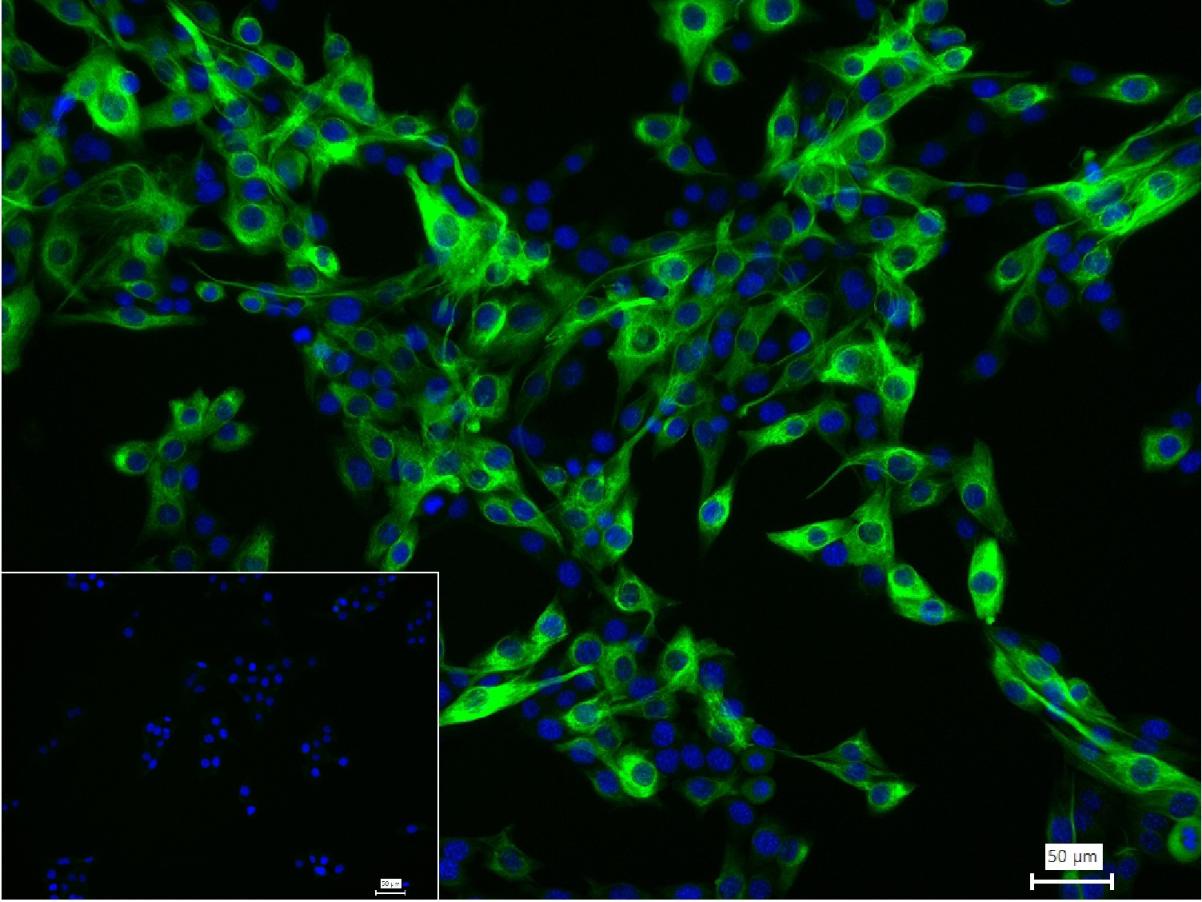 结蛋白重组兔单抗