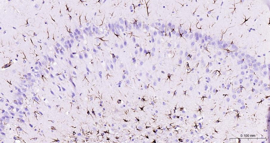 胶质纤维酸性蛋白重组兔单抗