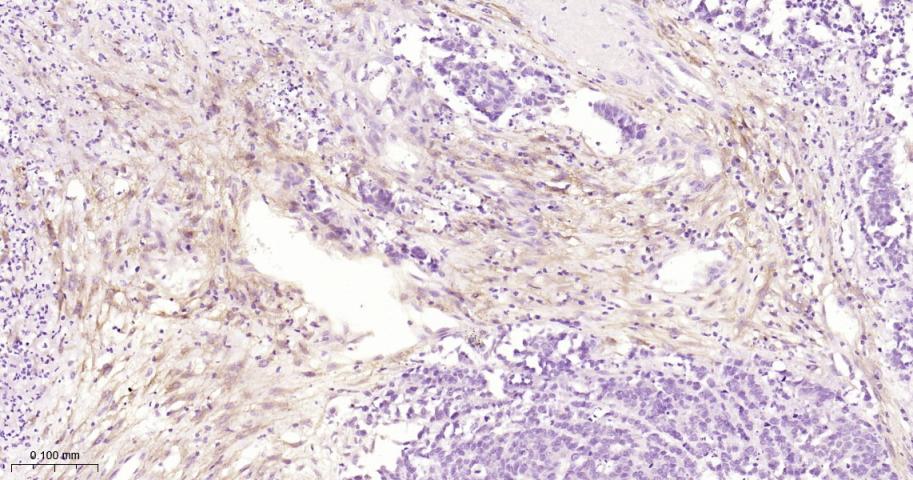 成纤维细胞激活蛋白α重组兔单抗