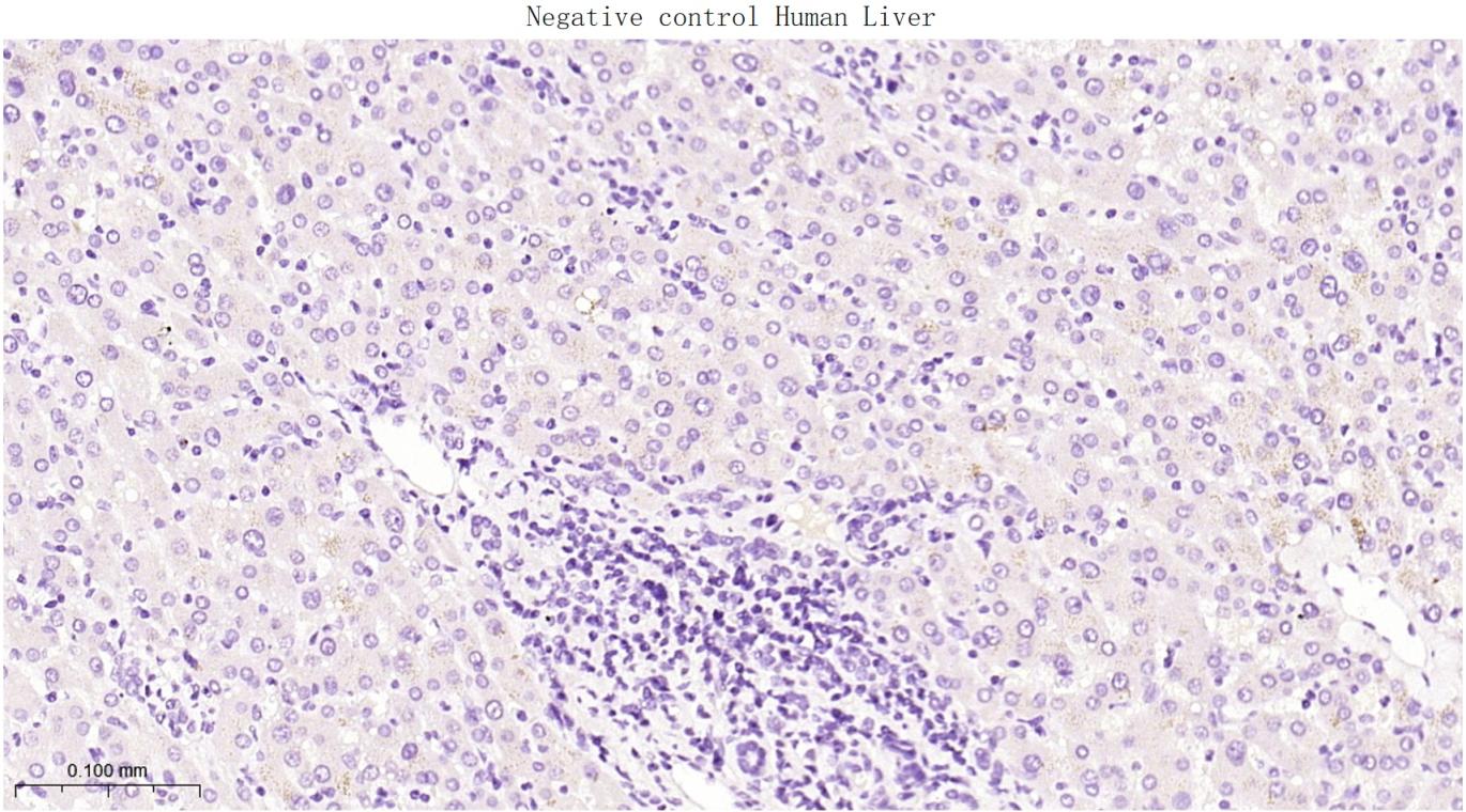 成纤维细胞激活蛋白α重组兔单抗