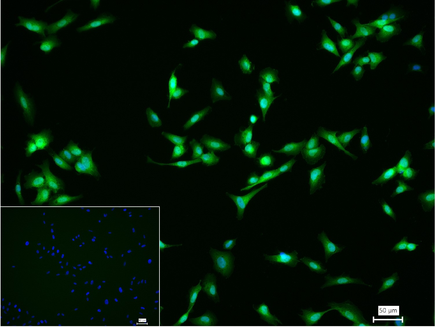 少突胶质细胞转录因子3重组兔单抗