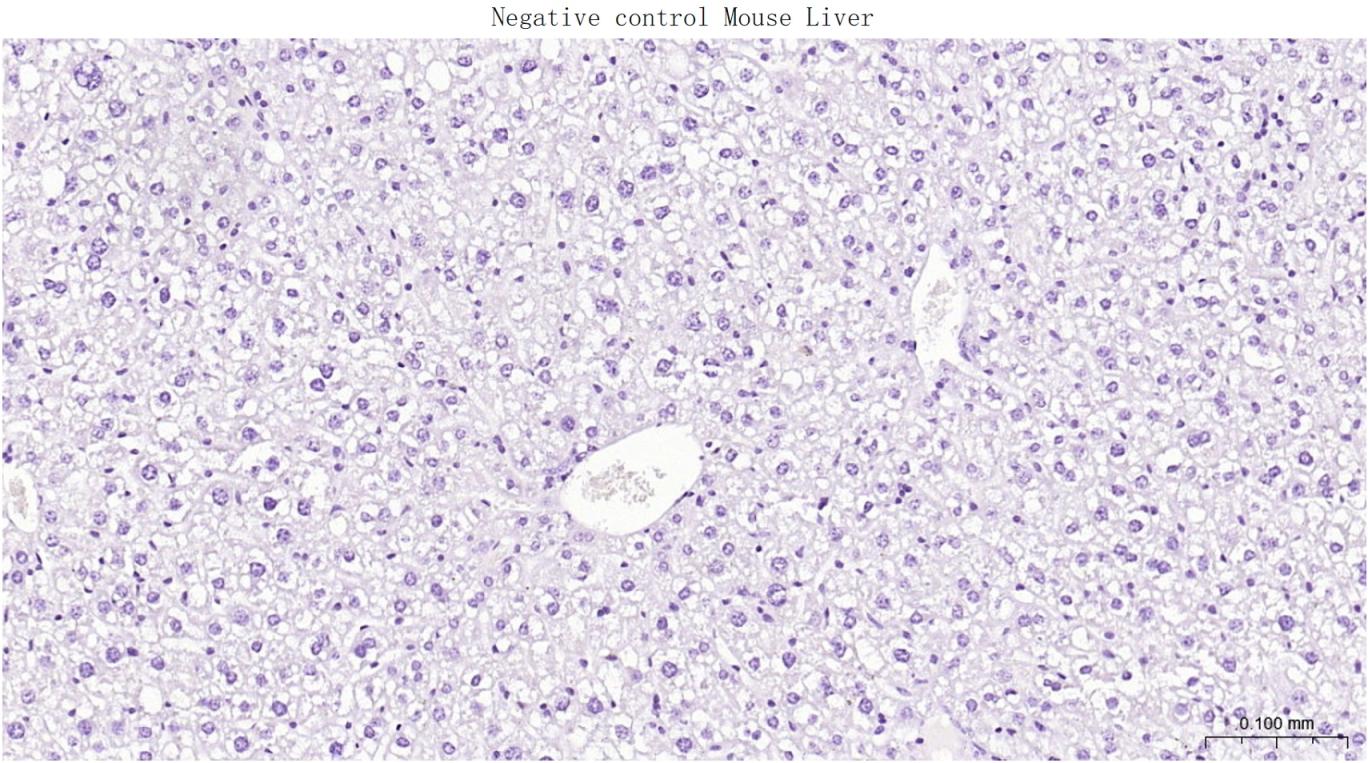 低分子量神经丝蛋白重组兔单抗