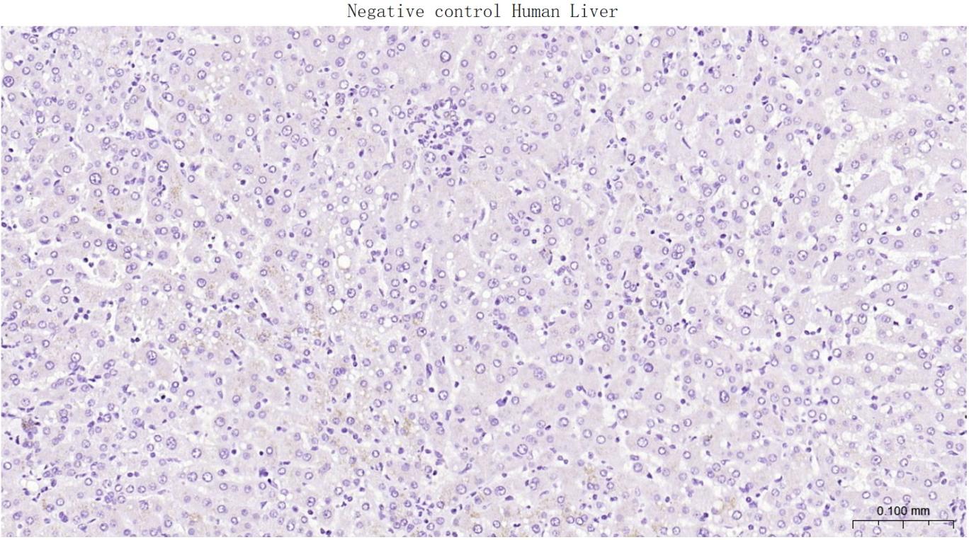 低分子量神经丝蛋白重组兔单抗