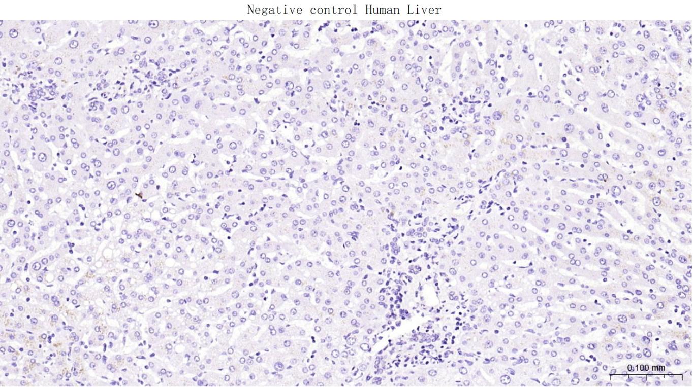 胶质纤维酸性蛋白重组兔单抗