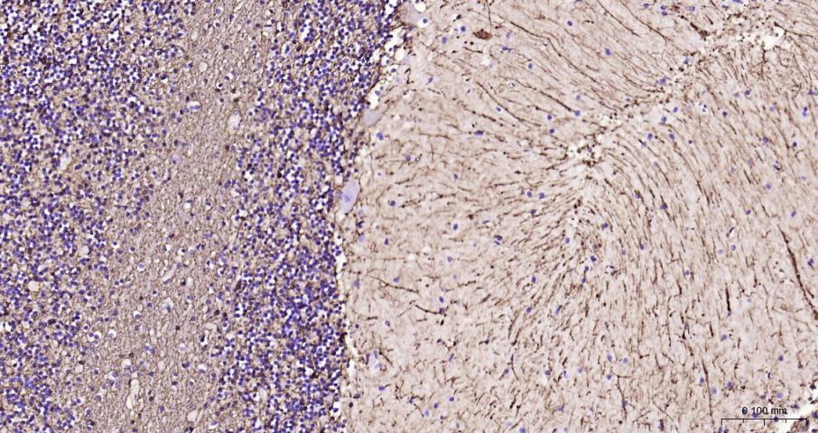 胶质纤维酸性蛋白重组兔单抗