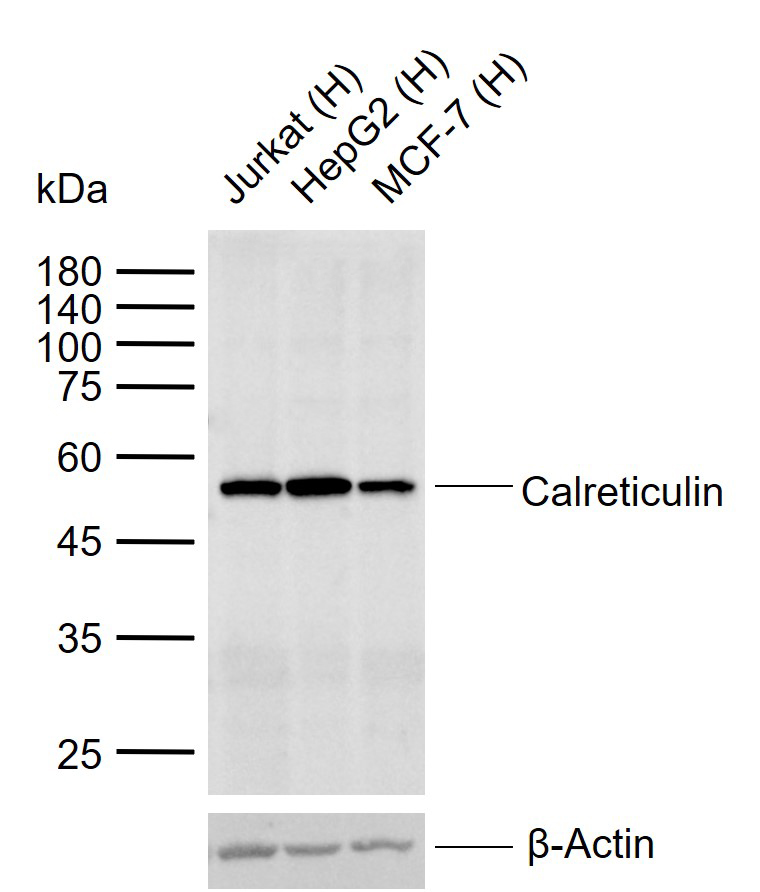 Calreticulin Rabbit pAb (一抗) - WB,IHC-P,IHC-F,IF,ELISA | Bioss
