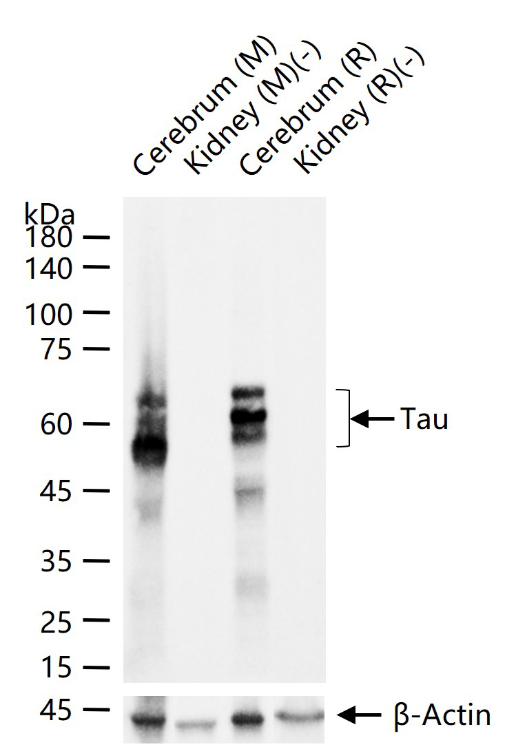 微管相关蛋白重组兔单抗