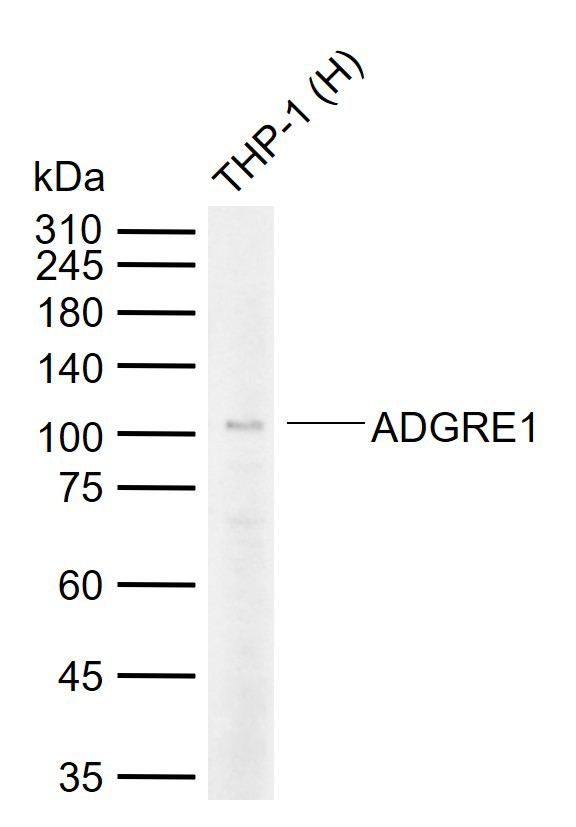 表皮生长因子样激素受体1（EMR1）重组兔单抗