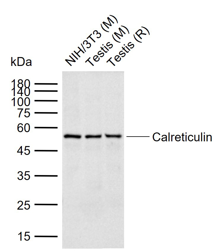钙网蛋白单克隆抗体-bsm-51748M