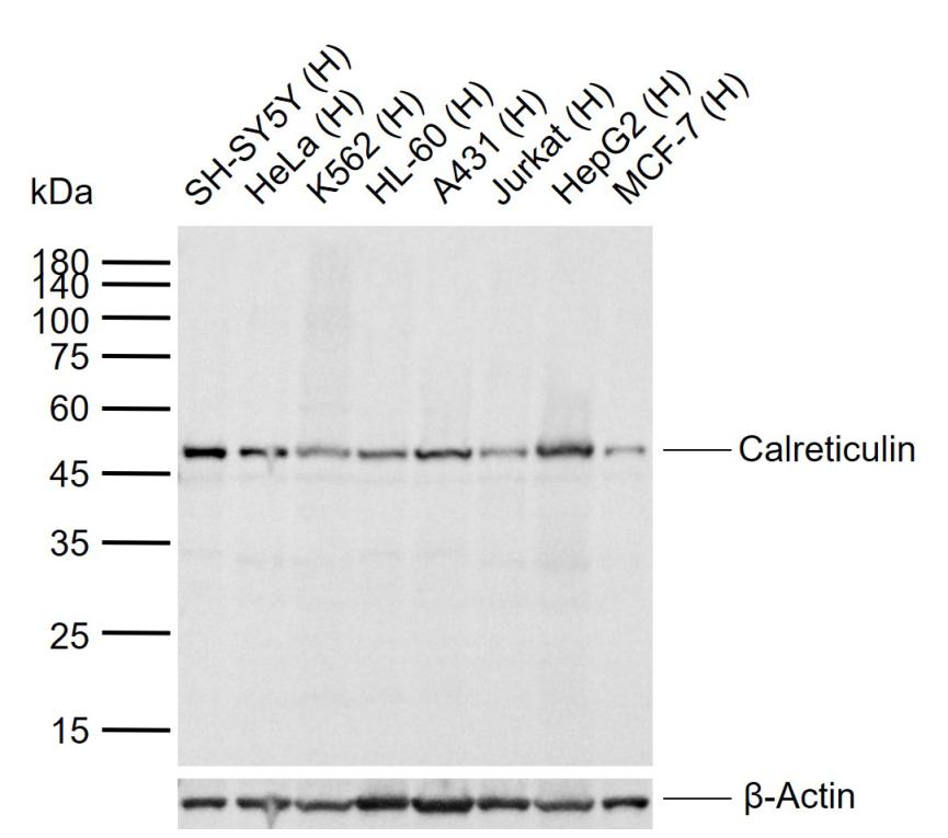 Calreticulin Mouse mAb (一抗) | Bioss