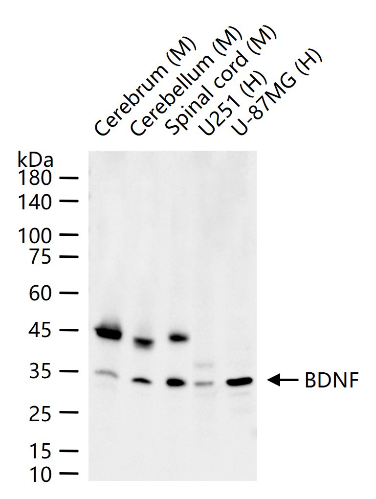 脑源神经营养因子重组兔单抗