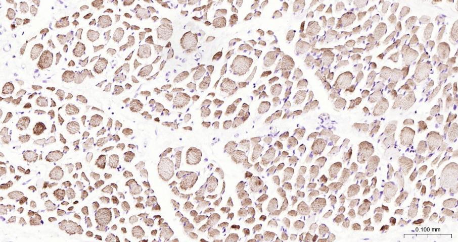 结蛋白单克隆抗体-bsm-33229M