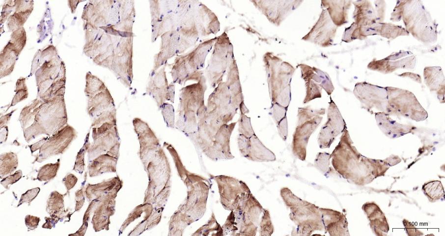 结蛋白单克隆抗体-bsm-33229M