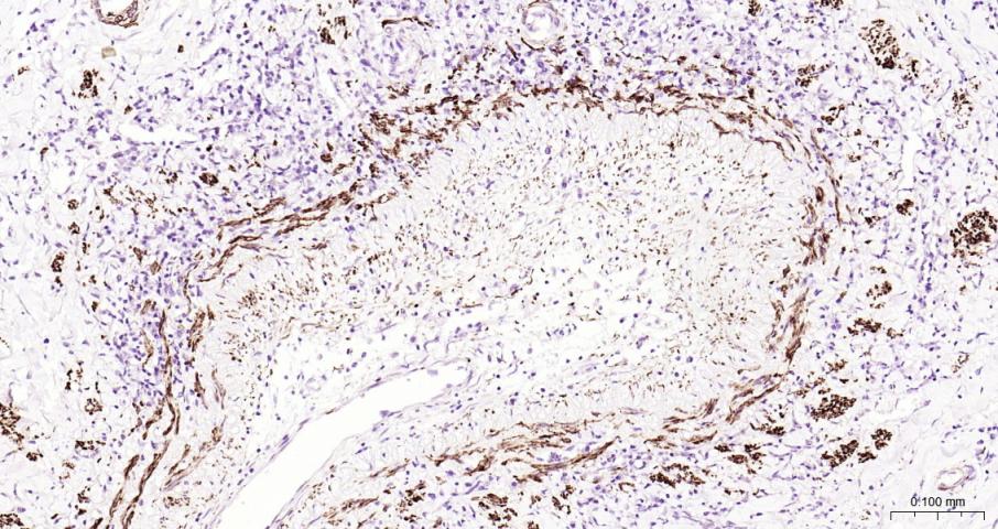 结蛋白单克隆抗体-bsm-33229M