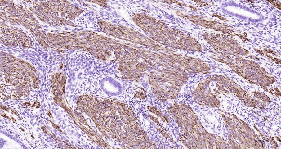 结蛋白单克隆抗体-bsm-33229M