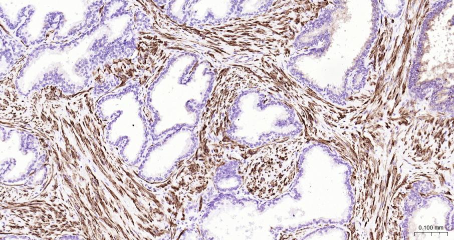 结蛋白单克隆抗体-bsm-33229M