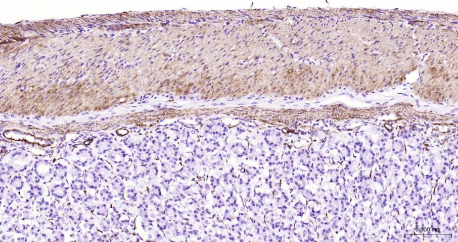 结蛋白单克隆抗体-bsm-33229M