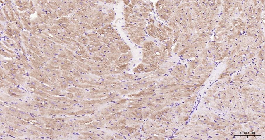 结蛋白单克隆抗体-bsm-33229M