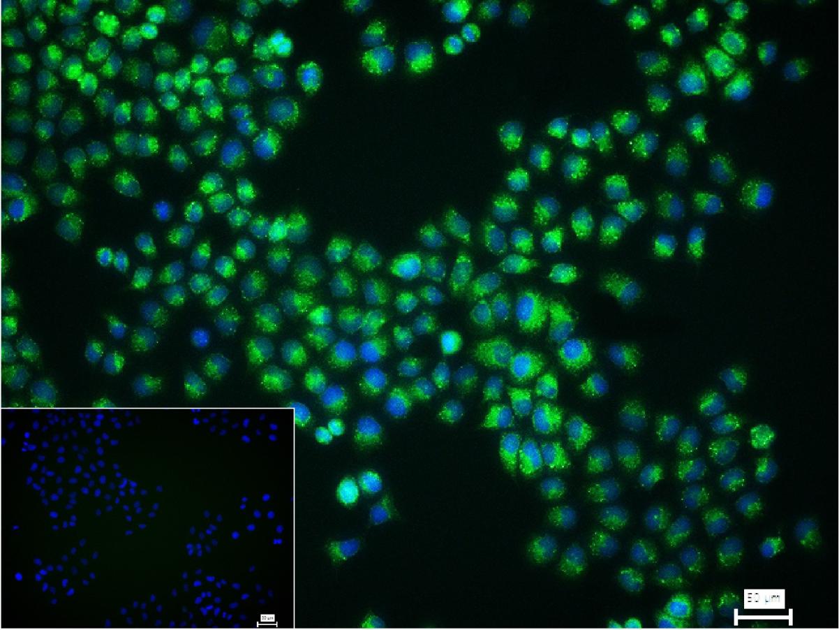 蛋白质二硫键异构酶重组兔单抗