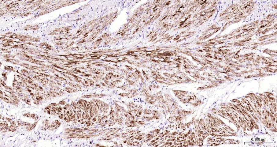结蛋白单克隆抗体-bsm-33229M