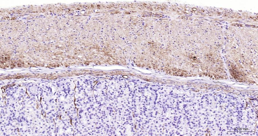 结蛋白单克隆抗体-bsm-33229M