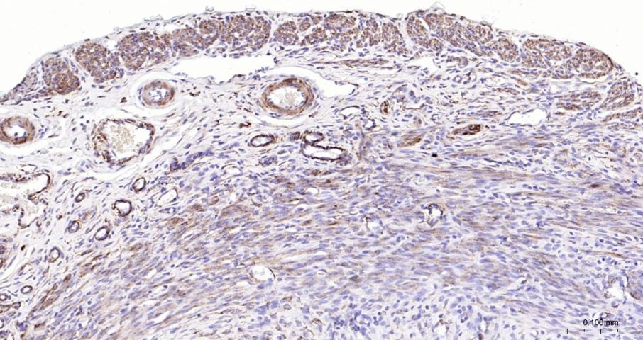 结蛋白单克隆抗体-bsm-33229M