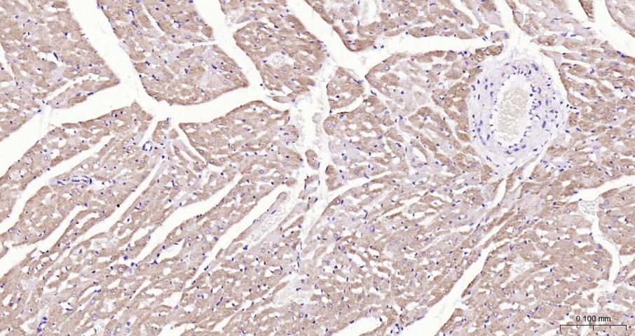 结蛋白单克隆抗体-bsm-33229M