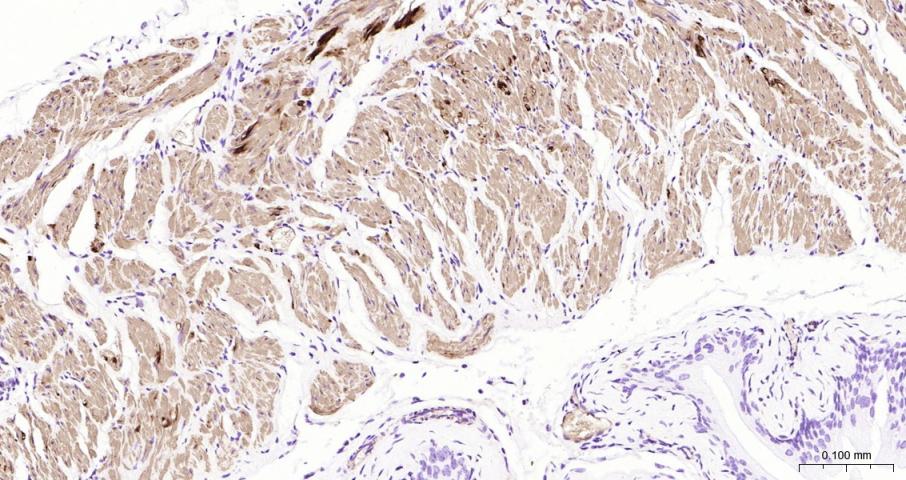 结蛋白单克隆抗体-bsm-33229M