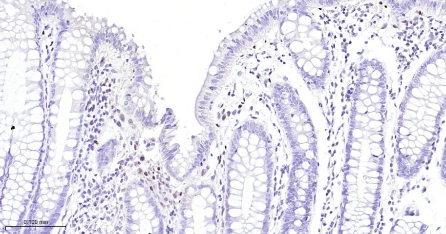 负调控因子白细胞介素2重组兔单抗