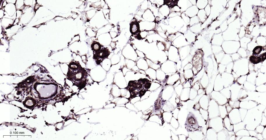 信号转导和转录激活因子5重组兔单抗