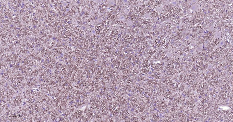 微管蛋白γ重组兔单抗