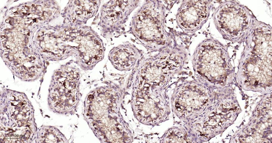 微管蛋白γ重组兔单抗