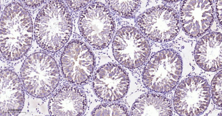 微管蛋白γ重组兔单抗