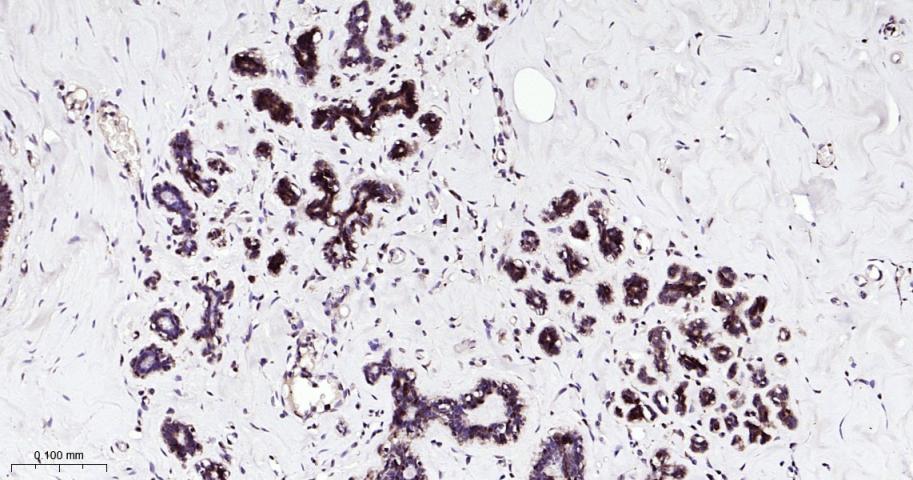 信号转导和转录激活因子5重组兔单抗