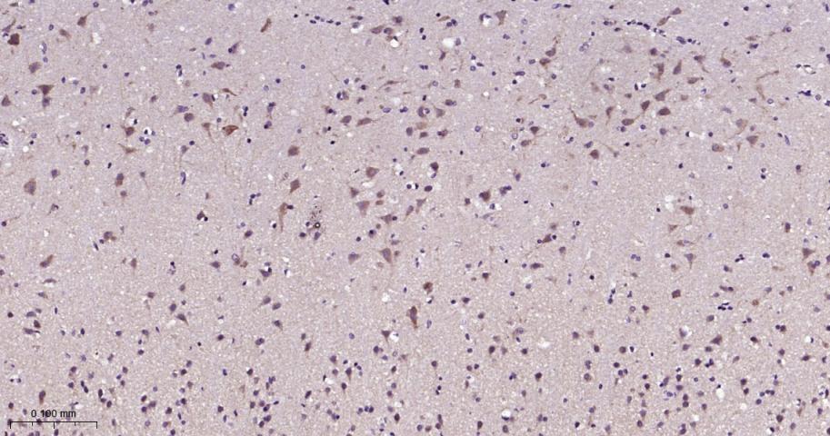 信号转导和转录激活因子5重组兔单抗