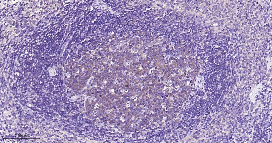 微管蛋白γ重组兔单抗